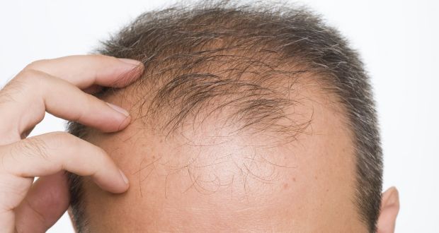 Hair Loss or Alopecia  CancerNet